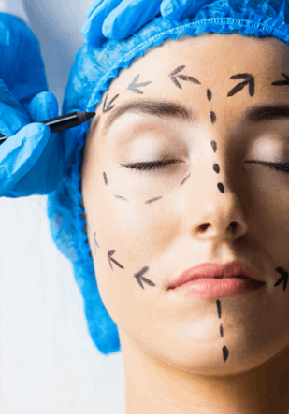 Rhinoplasty Treatment